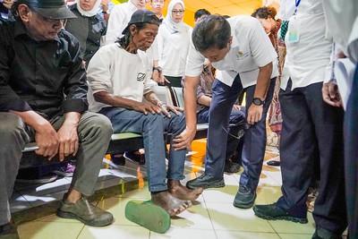 Menkes: Kusta Bukan Kutukan, Jangan Takut Lapor
